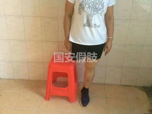长沙国安假肢康复用品有限公司,长沙假肢用品,国安假肢康复用品,假肢矫形器,康复器材,假肢配件,矫形器支具